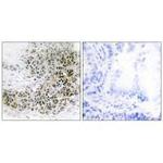 TRPS1 Polyclonal Antibody