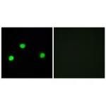 IP6K2 Polyclonal Antibody