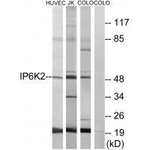 IP6K2 Antibody in Western Blot (WB)