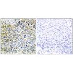 CARKL Polyclonal Antibody