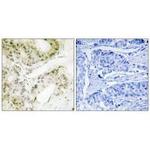 MED13 Polyclonal Antibody