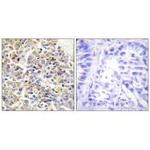 PYCARD Polyclonal Antibody