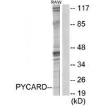 PYCARD Antibody in Western Blot (WB)