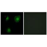 EID1 Polyclonal Antibody