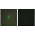 HTR2C Polyclonal Antibody