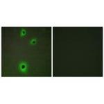 CADM4 Polyclonal Antibody