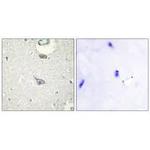 CADM4 Antibody in Immunohistochemistry (Paraffin) (IHC (P))
