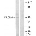 CADM4 Antibody in Western Blot (WB)