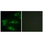 COL1A2 Polyclonal Antibody