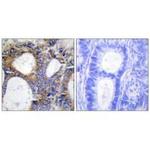 COL1A2 Antibody in Immunohistochemistry (Paraffin) (IHC (P))