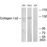 COL1A2 Antibody in Western Blot (WB)