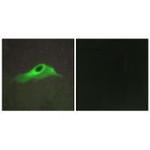 COL4A5 Polyclonal Antibody