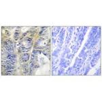 COL4A5 Antibody in Immunohistochemistry (Paraffin) (IHC (P))