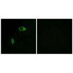 COL14A1 Antibody in Immunocytochemistry (ICC/IF)