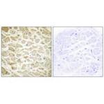 COL14A1 Antibody in Immunohistochemistry (Paraffin) (IHC (P))