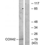 COX4I2 Antibody in Western Blot (WB)
