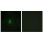 CYP2E1 Antibody in Immunocytochemistry (ICC/IF)