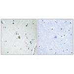 CYP2E1 Antibody in Immunohistochemistry (Paraffin) (IHC (P))