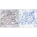 CYP4X1 Polyclonal Antibody