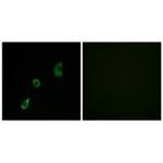 FGF23 Polyclonal Antibody