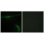 Laminin alpha-2 Polyclonal Antibody