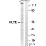 AGPAT5 Polyclonal Antibody