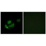 MRPL11 Polyclonal Antibody