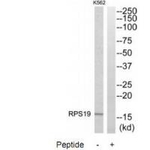 RPS19 Antibody in Western Blot (WB)