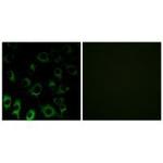 RPS4X Polyclonal Antibody