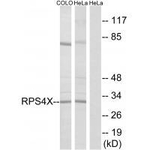 RPS4X Antibody in Western Blot (WB)