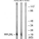 RPL26L1 Polyclonal Antibody