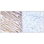 RPL3L Antibody in Immunohistochemistry (Paraffin) (IHC (P))