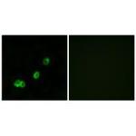 ACOT1 Polyclonal Antibody