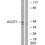 ACOT1 Antibody in Western Blot (WB)
