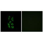 ACOT12 Polyclonal Antibody