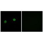 ACOT4 Polyclonal Antibody