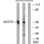 ACOT4 Antibody in Western Blot (WB)