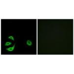 ACOT8 Polyclonal Antibody