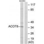 ACOT8 Antibody in Western Blot (WB)