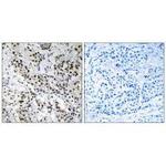 APBB2 Polyclonal Antibody