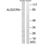 CARF Antibody in Western Blot (WB)