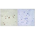 ANKRD26 Polyclonal Antibody