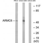 ARMC6 Antibody in Western Blot (WB)