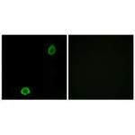 ABCA13 Polyclonal Antibody