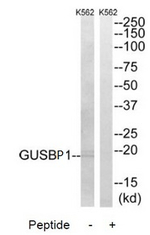 GUSBP1 Antibody in Western Blot (WB)