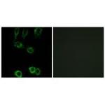 Calponin 2 Polyclonal Antibody