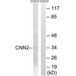Calponin 2 Antibody in Western Blot (WB)