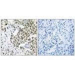 CAGE1 Antibody in Immunohistochemistry (Paraffin) (IHC (P))