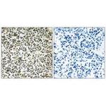 CEP152 Polyclonal Antibody