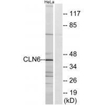 CLN6 Antibody in Western Blot (WB)
